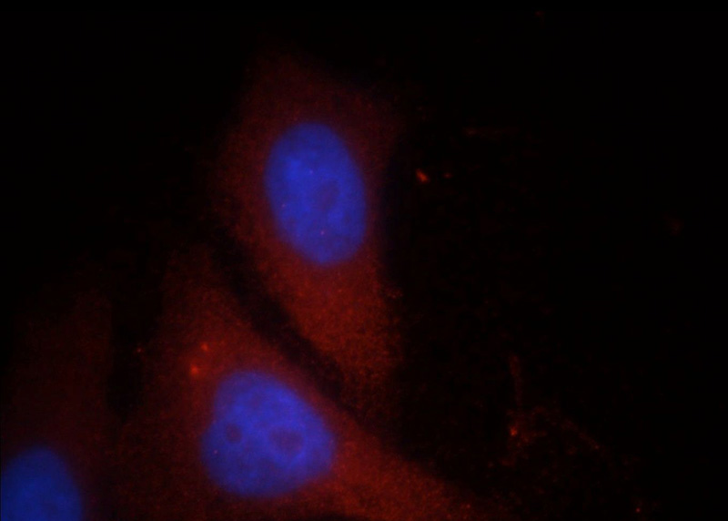 Immunofluorescent analysis of HepG2 cells, using FGL2 antibody Catalog No:110645 at 1:25 dilution and Rhodamine-labeled goat anti-rabbit IgG (red). Blue pseudocolor = DAPI (fluorescent DNA dye).
