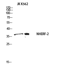 Fig1:; Western blot analysis of JK K562 using NHERF-2 antibody.. Secondary antibody（catalog#: HA1001) was diluted at 1:20000