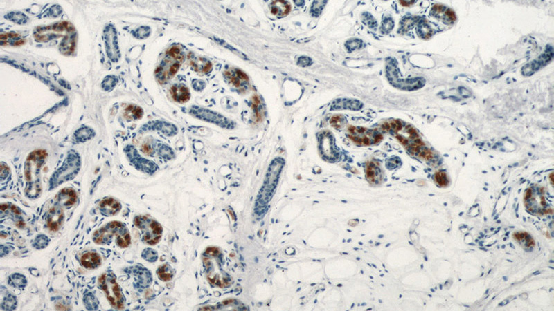 Immunohistochemical of paraffin-embedded human skin using Catalog No:116119(TIAF1 antibody) at dilution of 1:100 (under 10x lens)