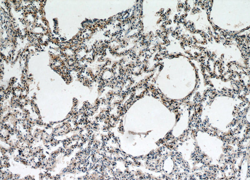 Immunohistochemical of paraffin-embedded human lung using Catalog No:110628(FGD5 antibody) at dilution of 1:100 (under 10x lens)
