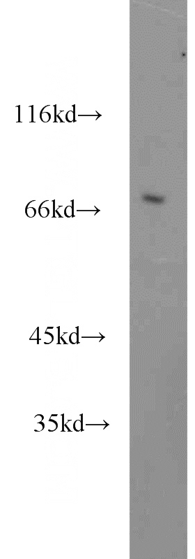 human heart tissue were subjected to SDS PAGE followed by western blot with Catalog No:110767(GAA antibody) at dilution of 1:600