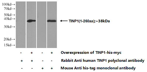 Transfected HEK-293 cells were subjected to SDS PAGE followed by western blot with Catalog No:116061(TINP1 Antibody) at dilution of 1:700