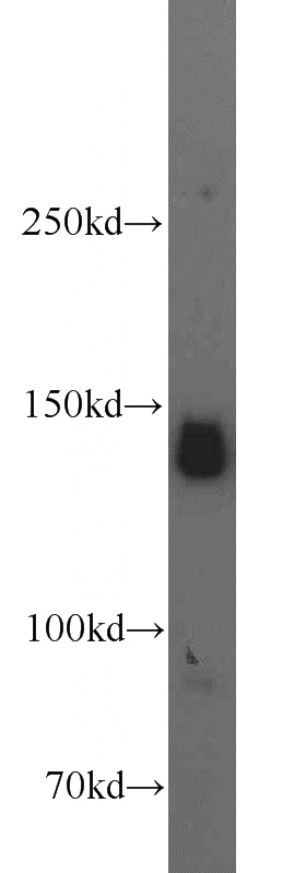 L02 cells were subjected to SDS PAGE followed by western blot with Catalog No:107907(AFF4 antibody) at dilution of 1:500