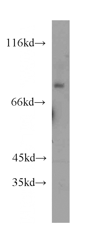 human skeletal muscle tissue were subjected to SDS PAGE followed by western blot with Catalog No:116082(TMCC1 antibody) at dilution of 1:500