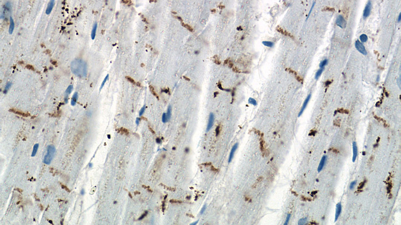 Immunohistochemistry of paraffin-embedded human heart tissue slide using (N-cadherin Antibody) at dilution of 1:200 (under 40x lens)
