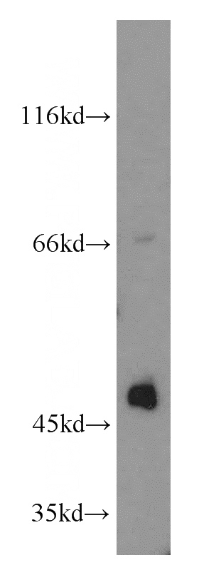 COLO 320 cells were subjected to SDS PAGE followed by western blot with Catalog No:117144(BGN antibody) at dilution of 1:800
