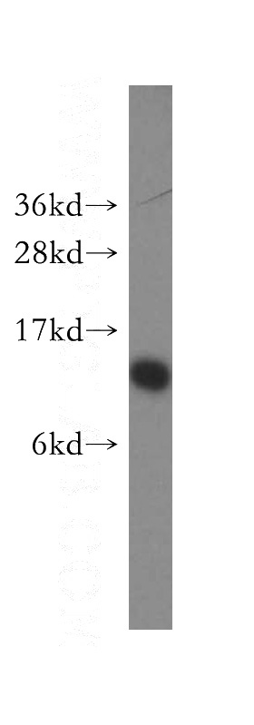 mouse pancreas tissue were subjected to SDS PAGE followed by western blot with Catalog No:115087(SEC61B antibody) at dilution of 1:500