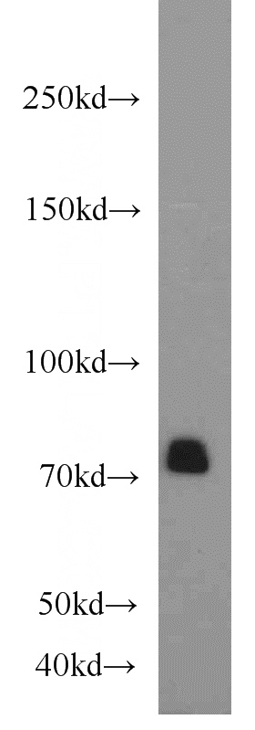 mouse brain tissue were subjected to SDS PAGE followed by western blot with Catalog No:113847(PRKCB antibody) at dilution of 1:1000