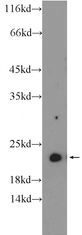 HEK-293 cells were subjected to SDS PAGE followed by western blot with Catalog No:113199(NKIRAS2 Antibody) at dilution of 1:600