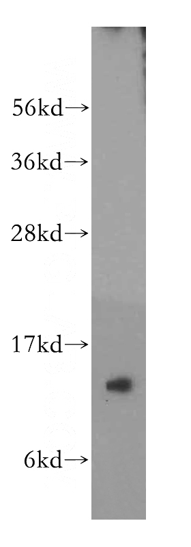MDA-MB-453s cells were subjected to SDS PAGE followed by western blot with Catalog No:110751(FXN antibody) at dilution of 1:500