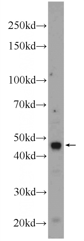 HEK-293 cells were subjected to SDS PAGE followed by western blot with Catalog No:111977(KCNN4 Antibody) at dilution of 1:1000