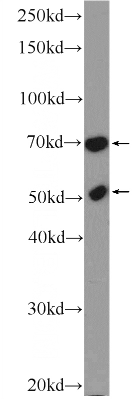 K-562 cells were subjected to SDS PAGE followed by western blot with Catalog No:110448(FLAD1 Antibody) at dilution of 1:600