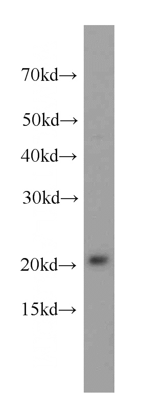 HeLa cells were subjected to SDS PAGE followed by western blot with Catalog No:113720(PRDX2 antibody) at dilution of 1:500