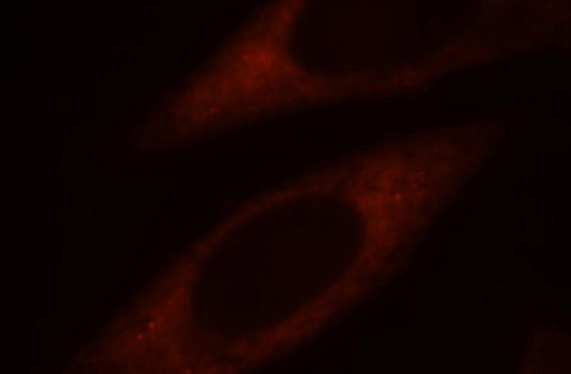 Immunofluorescent analysis of HepG2 cells, using RPS4Y1 antibody Catalog No:114909 at 1:25 dilution and Rhodamine-labeled goat anti-rabbit IgG (red).
