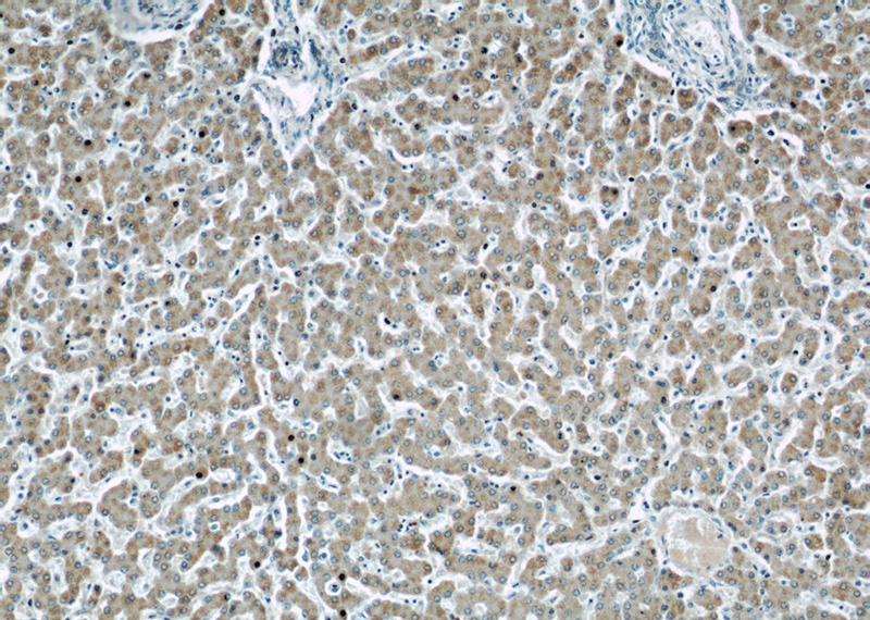 Immunohistochemical of paraffin-embedded human liver using Catalog No:107485(PHB antibody) at dilution of 1:50 (under 10x lens)