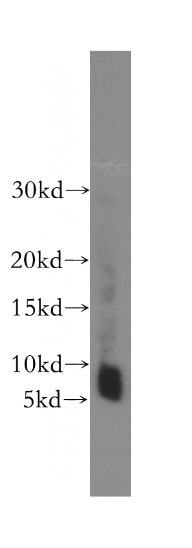 human skeletal muscle tissue were subjected to SDS PAGE followed by western blot with Catalog No:116242(TOMM6 antibody) at dilution of 1:400