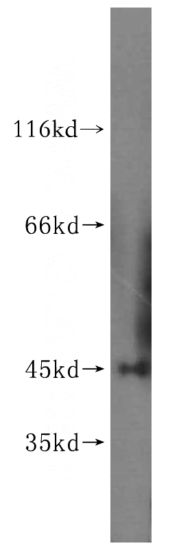 mouse kidney tissue were subjected to SDS PAGE followed by western blot with Catalog No:113867(PHYHIPL antibody) at dilution of 1:400