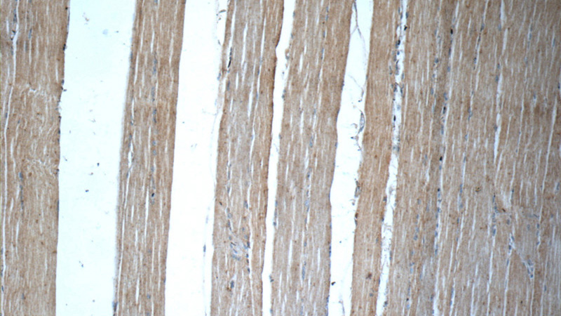 Immunohistochemistry of paraffin-embedded human skeletal muscle slide using Catalog No:115065(SAR1A Antibody) at dilution of 1:50