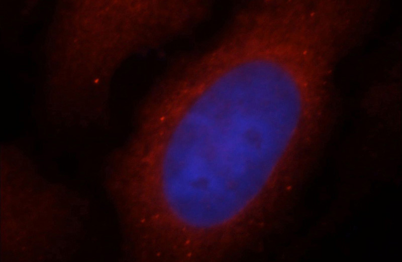 Immunofluorescent analysis of MCF-7 cells, using COG6 antibody Catalog No:109369 at 1:25 dilution and Rhodamine-labeled goat anti-rabbit IgG (red). Blue pseudocolor = DAPI (fluorescent DNA dye).