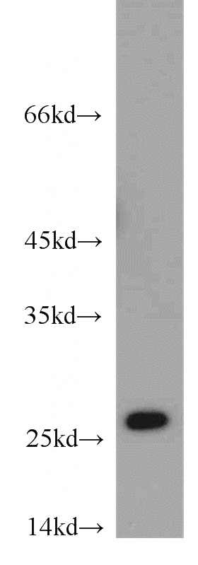 Jurkat cells were subjected to SDS PAGE followed by western blot with Catalog No:108180(ARHGDIB antibody) at dilution of 1:1000