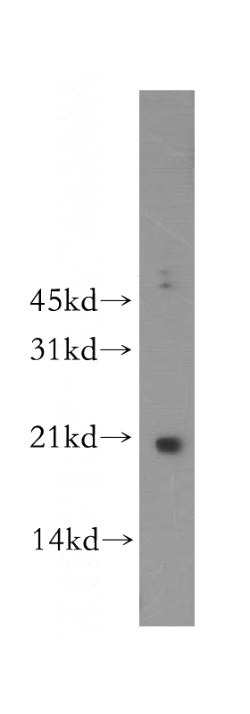 human lung tissue were subjected to SDS PAGE followed by western blot with Catalog No:112374(MAFF antibody) at dilution of 1:300