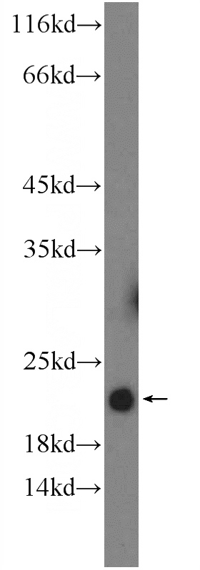 mouse liver tissue were subjected to SDS PAGE followed by western blot with Catalog No:116057(THRSP Antibody) at dilution of 1:1000