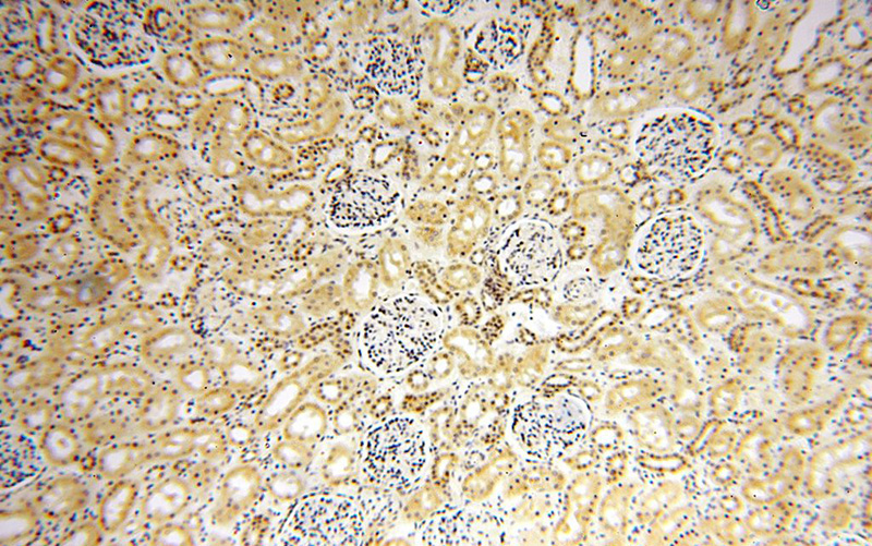 Immunohistochemical of paraffin-embedded human kidney using Catalog No:112603(MGMT antibody) at dilution of 1:100 (under 10x lens)