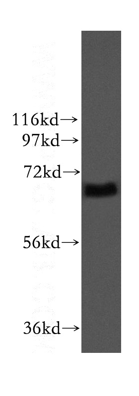 mouse testis tissue were subjected to SDS PAGE followed by western blot with Catalog No:111945(ITFG1 antibody) at dilution of 1:2000