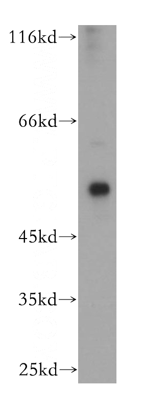 human skeletal muscle tissue were subjected to SDS PAGE followed by western blot with Catalog No:108910(CASQ2 antibody) at dilution of 1:500