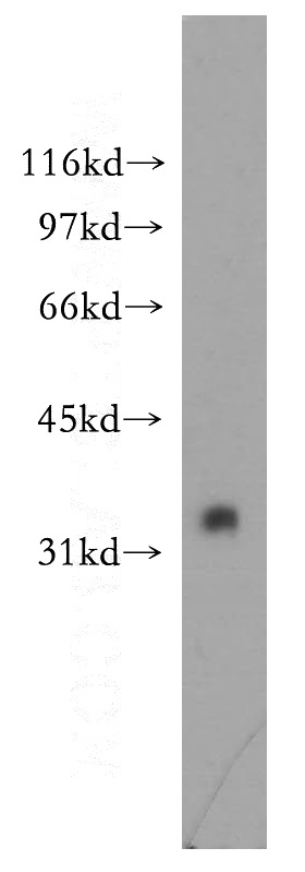 mouse testis tissue were subjected to SDS PAGE followed by western blot with Catalog No:114627(RFFL antibody) at dilution of 1:400