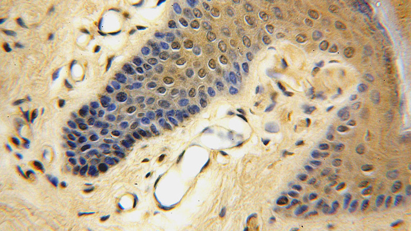 Immunohistochemical of paraffin-embedded human skin using Catalog No:108987(CCDC72 antibody) at dilution of 1:50 (under 40x lens)
