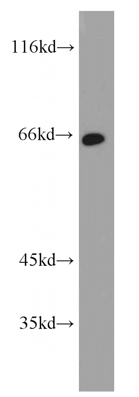 human stomach tissue were subjected to SDS PAGE followed by western blot with Catalog No:108838(CAPN9 antibody) at dilution of 1:1200