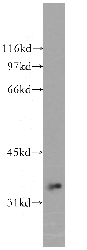 Raji cells were subjected to SDS PAGE followed by western blot with Catalog No:114256(PSTPIP2 antibody) at dilution of 1:500