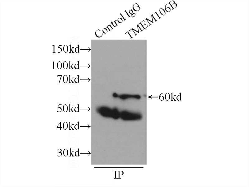 IP Result of anti-TMEM106B (IP:Catalog No:116091, 3ug; Detection:Catalog No:116091 1:1000) with mouse brain tissue lysate 6000ug.