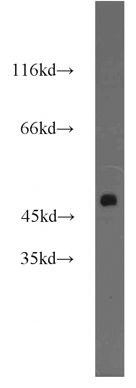 mouse liver tissue were subjected to SDS PAGE followed by western blot with Catalog No:111601(IDH1 antibody) at dilution of 1:2000