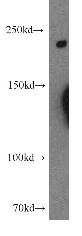 A549 cells were subjected to SDS PAGE followed by western blot with Catalog No:110047(DocK8 antibody) at dilution of 1:800