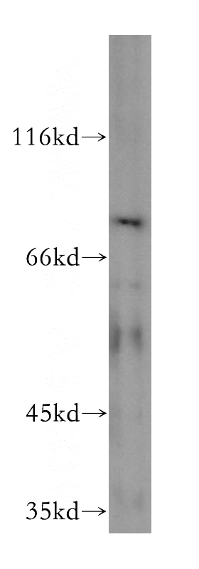 mouse testis tissue were subjected to SDS PAGE followed by western blot with Catalog No:116781(VPS33B antibody) at dilution of 1:500