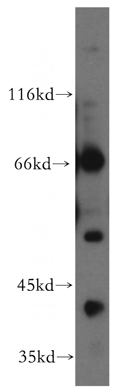 human placenta tissue were subjected to SDS PAGE followed by western blot with Catalog No:113759(PCYT1B antibody) at dilution of 1:500