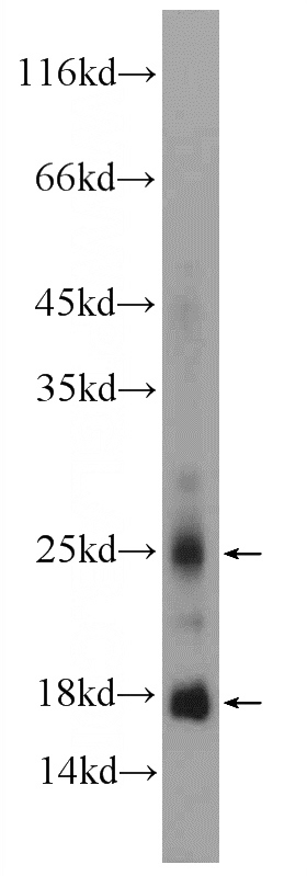 mouse eye tissue were subjected to SDS PAGE followed by western blot with Catalog No:109587(CRYGN Antibody) at dilution of 1:300