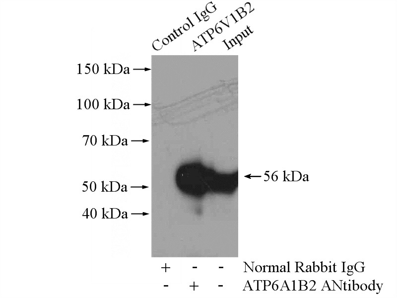 IP Result of anti-ATP6V1B2 (IP:Catalog No:108307, 4ug; Detection:Catalog No:108307 1:1000) with mouse brain tissue lysate 4000ug.