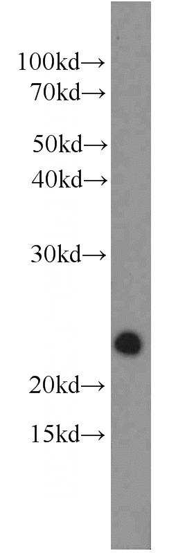 NIH/3T3 cells were subjected to SDS PAGE followed by western blot with Catalog No:114921(RRAS2 antibody) at dilution of 1:800