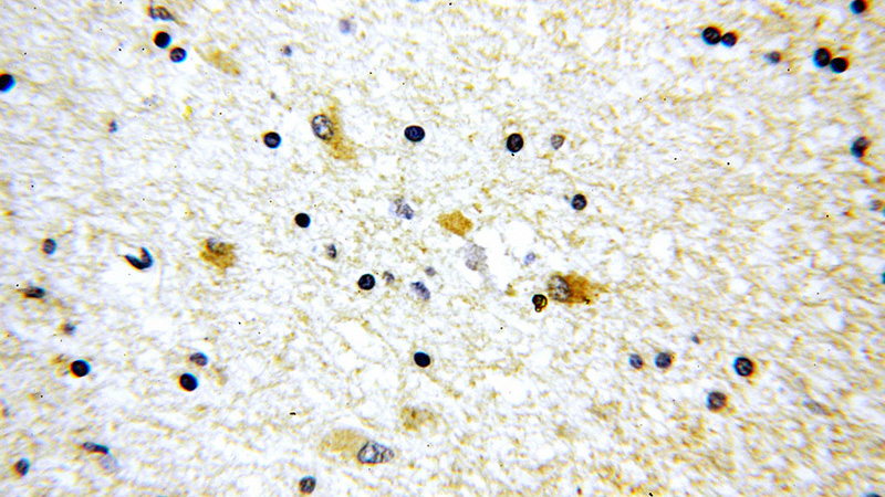 Immunohistochemical of paraffin-embedded human brain using Catalog No:115754(SV2B antibody) at dilution of 1:100 (under 40x lens)