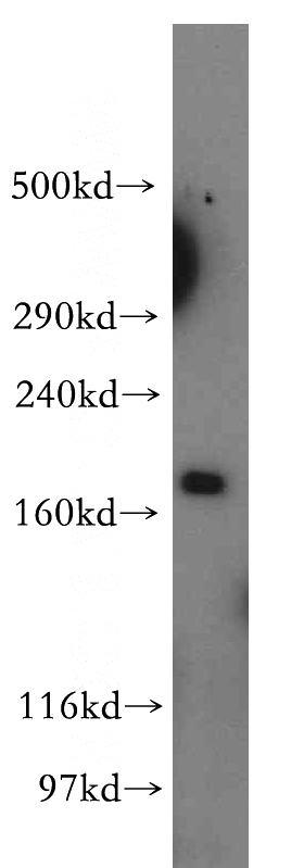 human brain tissue were subjected to SDS PAGE followed by western blot with Catalog No:111907(KALRN antibody) at dilution of 1:500