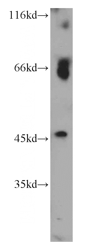 Jurkat cells were subjected to SDS PAGE followed by western blot with Catalog No:109276(CHRFAM7A antibody) at dilution of 1:200