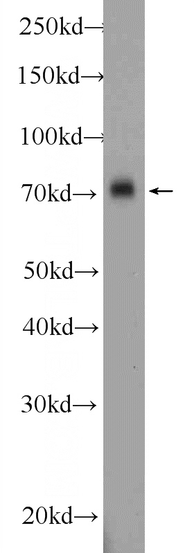 mouse brain tissue were subjected to SDS PAGE followed by western blot with Catalog No:108020(APLP1 Antibody) at dilution of 1:1000
