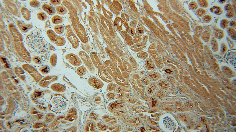 Immunohistochemical of paraffin-embedded human kidney using Catalog No:109237(CHMP7 antibody) at dilution of 1:100 (under 10x lens)
