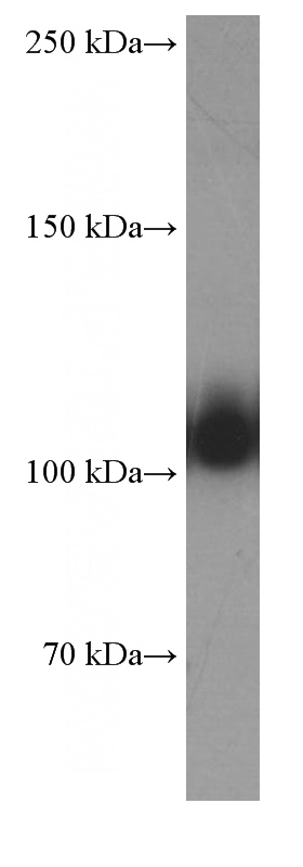 human heart tissue were subjected to SDS PAGE followed by western blot with Catalog No:107345(OGDH Antibody) at dilution of 1:2500