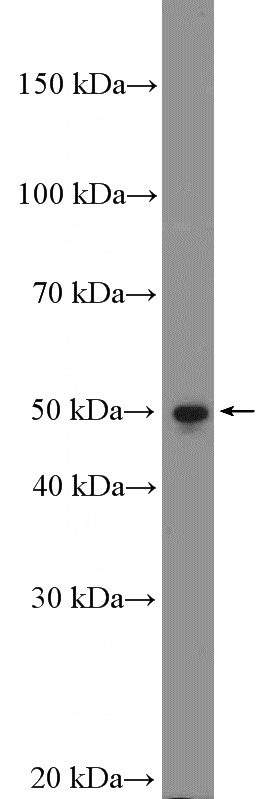 HeLa cells were subjected to SDS PAGE followed by western blot with Catalog No:116850(WBSCR16 Antibody) at dilution of 1:600