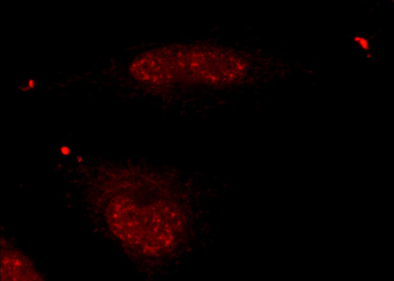 Immunofluorescent analysis of HUVEC cells using Catalog No:116681(USP39 Antibody) at dilution of 1:25 and Rhodamine-Goat anti-Rabbit IgG
