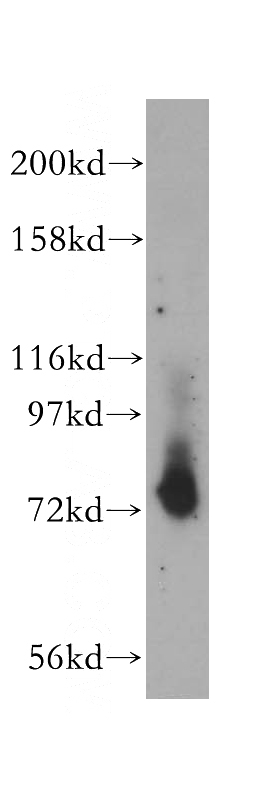 mouse lung tissue were subjected to SDS PAGE followed by western blot with Catalog No:115904(TCF12 antibody) at dilution of 1:300